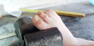 Besplatna pravna pomoć za žrtve torture Tortura, ilustracija; Foto: Pixabay