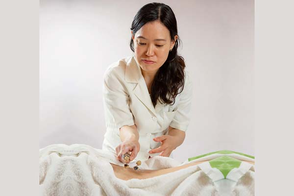 Akupunktura, terapija; Foto: Balansmedika