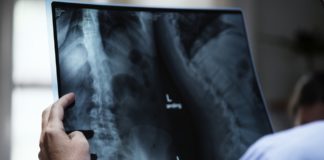 Kako se osloboditi bolova u ledjima Bol u ledjima