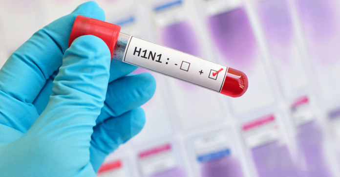 h1n1 Grip AH1N1