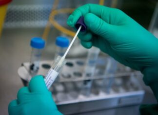 RFZO: Povraćaj novca datog za testiranje na korona virus registrovano najviše