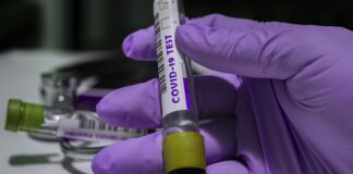 PCR test: Od danas rezultat putem SMS-a ili i-mejla PCR test