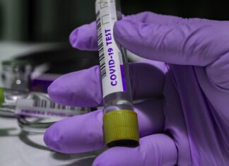PCR test: Od danas rezultat putem SMS-a ili i-mejla PCR test