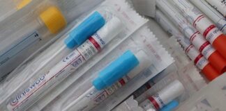 Tiodorović: Antigenski testovi na korona virus nije trebalo da se nađu u slobodnoj prodaji antigenski testovi na korona virus