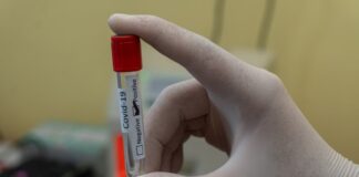 Istraživanje: U teorije zavere o koroni veruje 41,5% Srba, trećina odbija vakcinu teorije zavere