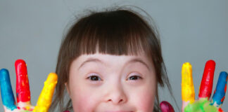 Danas je svetski dan osoba sa Daunovim sindromom daunov sindrom