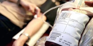 Nurdor i Zavod za transfuziju krvi organizuju akciju „Zajedno smo jači“ nurdor