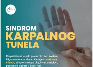 Sindrom karpalnog tunela