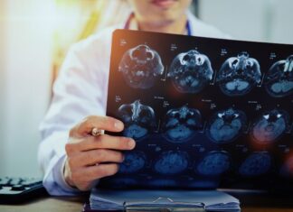 Neurohirurzi imaju sve više posla neurohirurgija