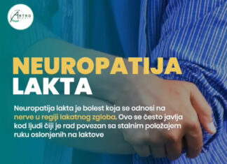 Neuropatija lakta Neuropatija lakta