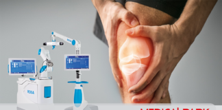 Robot u operacionoj sali! Kako izgleda zamena kolena robotom ROSA? robot operacija kolena