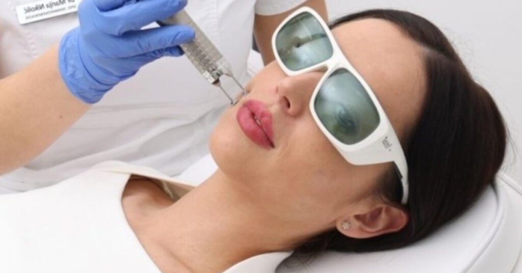twinlight podmladjivanje laserom poliklinika diva dr bogdanovic beograd